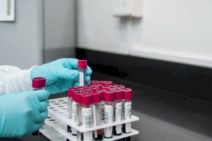 
                    В Казахстане продолжает снижаться заболеваемость COVID-19
                