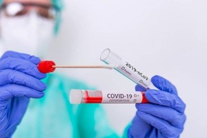За сутки в Казахстане зарегистрировали 12 новых случаев заражения коронавирусом