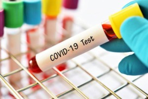 
                    За сутки в Казахстане выявили 78 случаев заболевания COVID-19
                