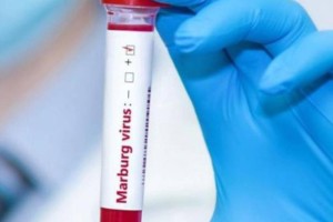 Минздрав усиливает контроль в связи со вспышкой новой опасной инфекции