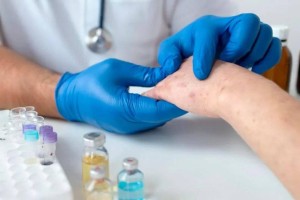 Ситуация с корью в Астане остается напряженной