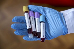 За сутки коронавирусом заразились 34 казахстанца
