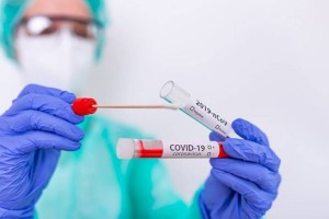 
                    За прошедшие сутки коронавирусом заразились 45 казахстанцев
                