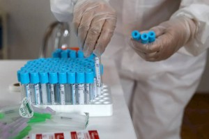 
                    Заболеваемость коронавирусом в Казахстане продолжает идти на спад
                