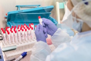 За сутки коронавирусной инфекцией заразились более 90 казахстанцев