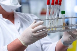 
                    За прошедшие сутки коронавирусом заразились 63 казахстанца
                
