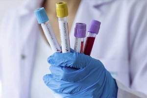 
                    За сутки коронавирусом заразились менее ста казахстанцев
                