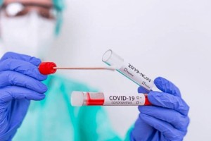 
                    За сутки в РК зарегистрировано 116 случаев заболевания COVID-19 и ковидной пневмонией
                