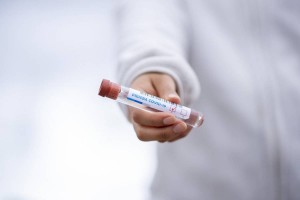 
                    Сколько казахстанцев  получают лечение от КВИ
                
