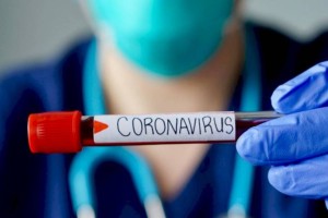 В Казахстане за сутки COVID-19 заразился 231 человек