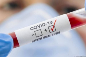 
                    За прошедшие сутки в стране выявили 50 случаев заболевания КВИ
                