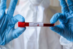 
                    В Казахстане за сутки зарегистрирован 51 случай заражения COVID-19
                