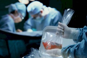 
                    Более 100 операций по пересадке органов провели в Казахстане с начала года
                