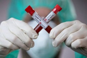 
                    Плюс 23 выздоровевших от коронавируса казахстанца за сутки
                