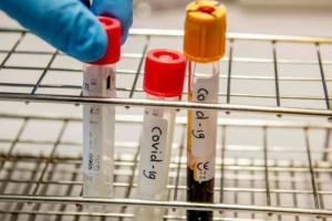В Казахстане за сутки новые случаи коронавируса выявлены в трех регионах страны