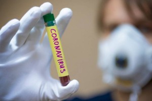 
                    Восемь казахстанцев заразились коронавирусом за прошедшие сутки
                