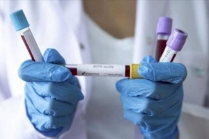 
                    Более 50 случаев заболевания коронавирусом выявили за сутки в Казахстане
                