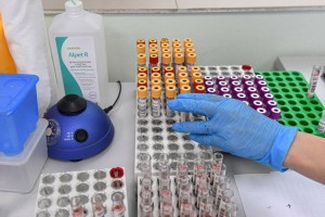 
                    В Казахстане наблюдается незначительный прирост заболевших COVID-19 за сутки
                