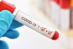 
                    В Казахстане суточный уровень заболеваемости COVID-19 неуклонно идет на спад
                