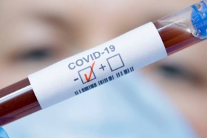 
                    Плюс 3533 выздоровевших от коронавируса казахстанца за сутки
                
