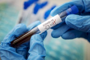 
                    В Казахстане за сутки зарегистрировано 457 новых случаев заболевания коронавирусом
                