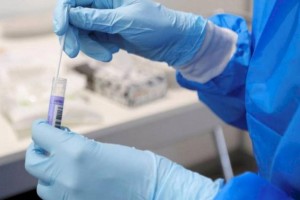 За сутки в Казахстане выявлены 440 заболевших COVID-19