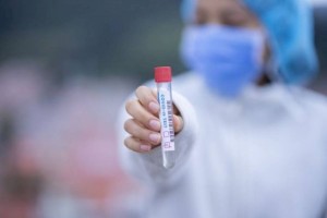 
                    В Казахстане за сутки зарегистрировано 753 новых случая заражения COVID-19
                