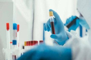 
                    За сутки диагноз COVID-19 подтвердился у 7899 казахстанцев
                