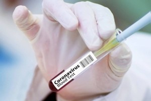 
                    В Казахстане за сутки выявлено 1144 случая заражения коронавирусом
                