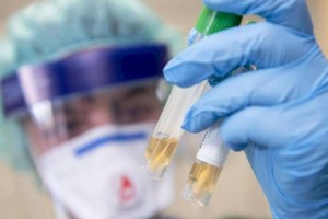 
                    Коронавирус запускает в организме процесс старения
                