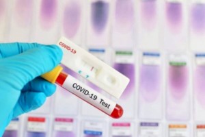 
                    В Казахстане 693 новых случая заболевания коронавирусом
                