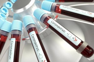 
                    Стали известны новые данные о суточной заболеваемости коронавирусом в РК
                