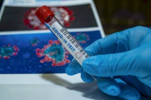 
                    Суточный прирост COVID-19 в Казахстане составил 753 человека
                