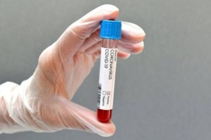 За прошедшие сутки в РК зарегистрировано 699 заразившихся коронавирусом