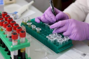 В Казахстане за сутки выявлено 869 новых случаев заражения COVID-19
