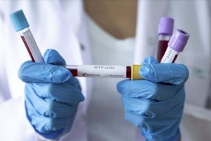 
                    В РК за сутки выявлено 753 заболевших COVID-19
                