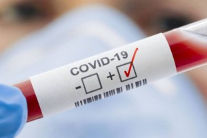 
                    В Казахстане за сутки выявлено 739 новых случаев коронавируса
                