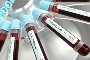 
                    788 новых случаев коронавируса зарегистрировано в Казахстане
                