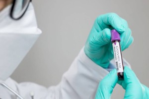 
                    670 казахстанцев заболели COVID-19 за прошедшие сутки
                