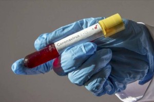 
                    819 случаев заболевания COVID-19 выявлено в Казахстане за прошедшие сутки
                