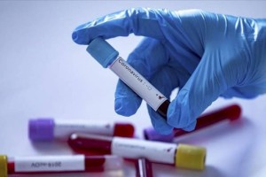 
                    В Казахстане за сутки выявлено 165 случаев заражения COVID-19
                
