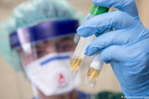 
                    84 случая заболевания коронавирусной пневмонией зарегистрировано в Казахстане за сутки
                