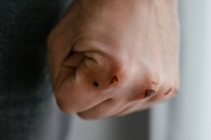 
                    Число убийств в семьях падает втрое быстрее — омбудсмен Ластаев о борьбе с насилием
                
