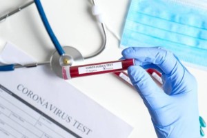 
                    Зарубежный мошенник нелегально проводил тесты на COVID-19
                