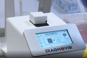 
                    Десятисекундный тест на коронавирус изобрели в Турции
                