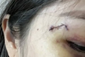 Агрессивная пациентка напала на врачей в Алматы