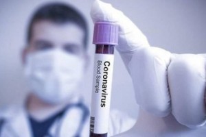 
                    Названы признаки, указывающие на бессимптомно перенесенный коронавирус
                