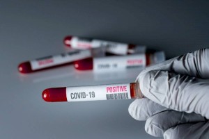 
                    729 новых случаев COVID-19 зарегистрировано в Казахстане
                