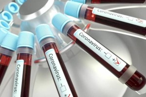 
                    В Казахстане увеличилось число заболевших коронавирусом
                