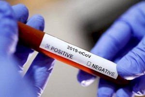 В Казахстане за сутки выявлен 781 случай заболевания пневмонией с признаками COVID-19